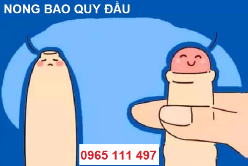 Nong Bao Quy Dau 1