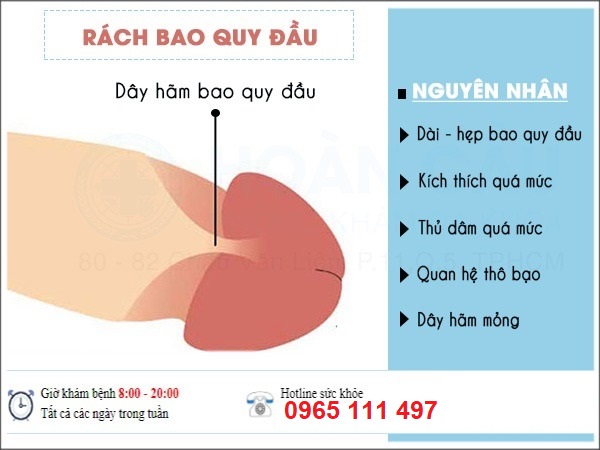 Rach Bao Quy Dau La Gi