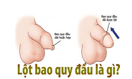 lot-bao-quy-dau-la-gi