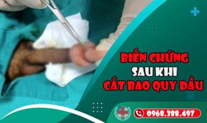 Bien Chung Sau Khi Cat Bao Quy Dau 1