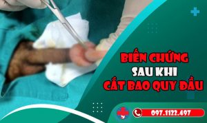 Biến Chứng Sau Khi Cắt Bao Quy đầu 1