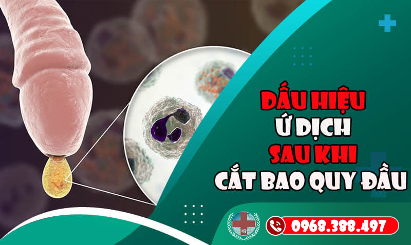 Cat Bao Quy Dau Xong Bi U Dich 1