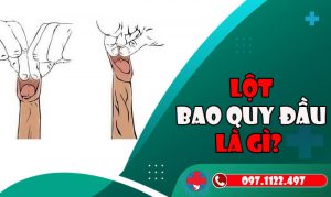Lột Bao Quy đầu