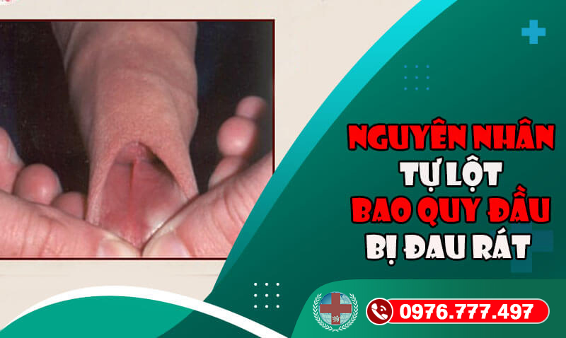 Tự Lột Bao Quy đầu 1
